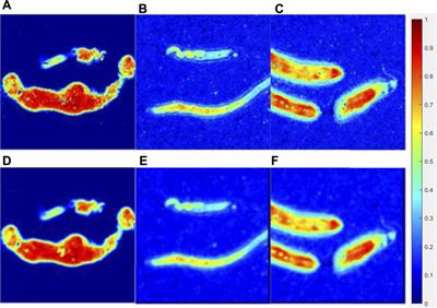 Effect of the Samples’ Surface With Complex Microscopic Geometry on 3 × 3 Mueller Matrix Measurement of Tissue Bulks